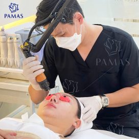 Laser Picosecond bật sắc tố nám 
